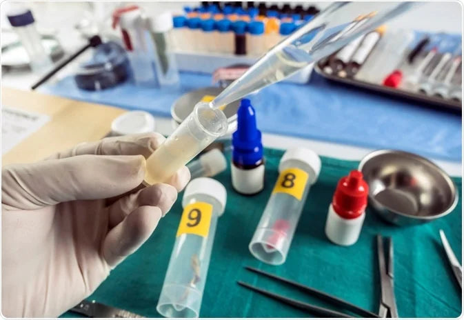 Procedure for pH guidelines